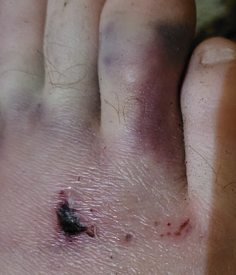 Screenshot_20221125_175911