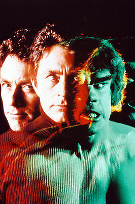 Bill-Bixby-As-Dr-David-Bruce-Banner-In